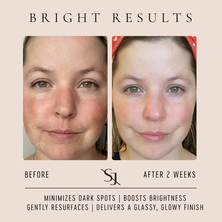 Vitamin C Brightening Serum